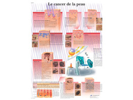 POSTER LE CANCER DE LA PEAU - VR2295L