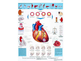 POSTER L INFARCTUS DU MYOCARDE - VR2342L