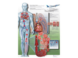 POSTER THROMBOSE VEINEUSE PROFONDE - FRANCAIS - VR2368L
