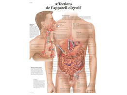 POSTER AFFECTIONS DE L APPAREIL DIGESTIF - VR2431L