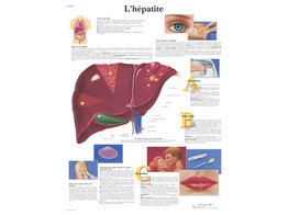 POSTER L HEPATITE - VR2435L