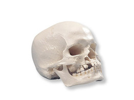 HUMAN SKULL MODEL WITH CLEFT JAW AND PALATE - A29/3  1000067 