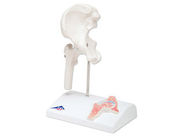 MINI-ARTICULATION DE LA HANCHE AVEC COUPE TRANSVERSALE  SUR SOCLE- A 84/1  1000168