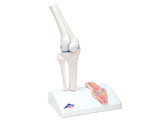  br/ MINI KNEE JOINT WITH CROSS SECTION - A 85/1  1000170 