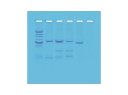 EDVOTEK  DNA FINGERPRINTING USING RESTRICTION ENZYMES  225