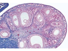 Ovary of cat  t.s. for general study  shows primary  secondary and Graafian follicles